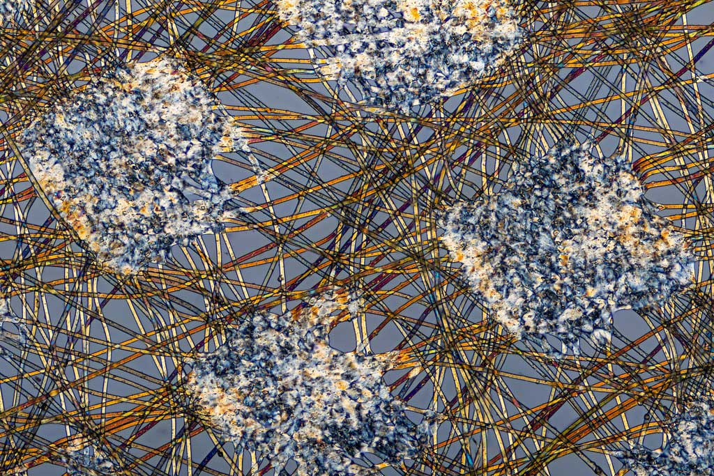 Microscopic image of the outer layer of a surgical mask, made from melt blown polymer filaments.